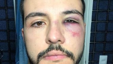 Após reagir a assalto, jornalista Matheus Ribeiro é agredido: “não fiz o correto”