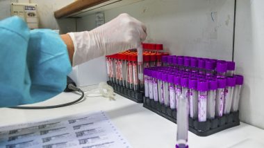 Goiás fecha fevereiro com aumento de 51% no número de mortos por Covid-19