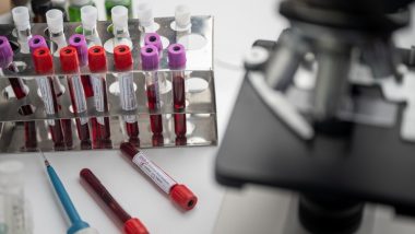 Testagem em massa para Covid-19 apresenta tendência de queda de positivados